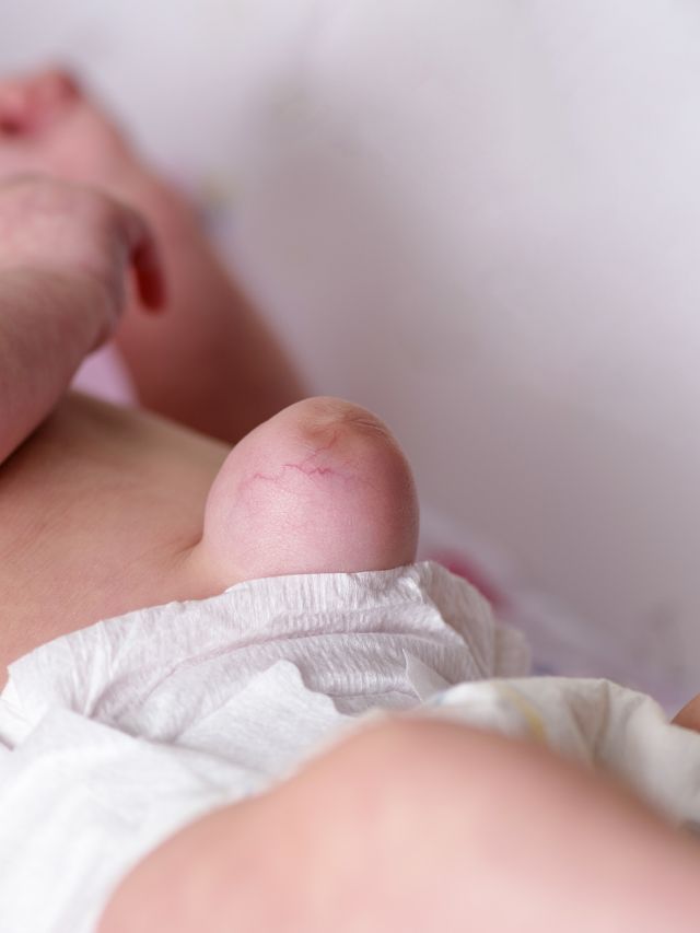 Read more about the article BEST YOGA POSES FOR HERNIA