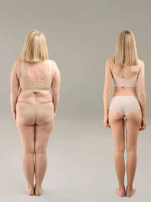 Read more about the article EFFECTIVE YOGA POSES FOR REDUCING BODY BACK FAT