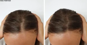 Read more about the article 11 Yoga Poses For Healthy Hair Growth