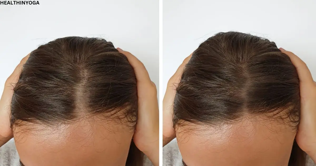 Read more about the article 11 Yoga Poses For Healthy Hair Growth