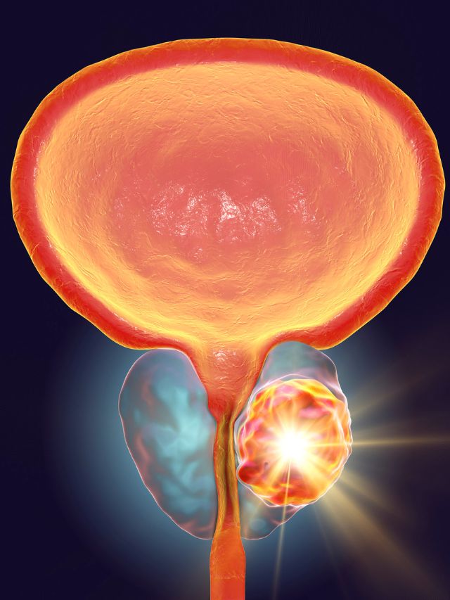 Read more about the article YOGA POSES FOR PROSTATE ENLARGEMENT