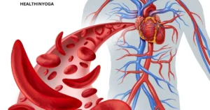 Read more about the article Increase Hemoglobin Level and Prevent Anemia with Yoga