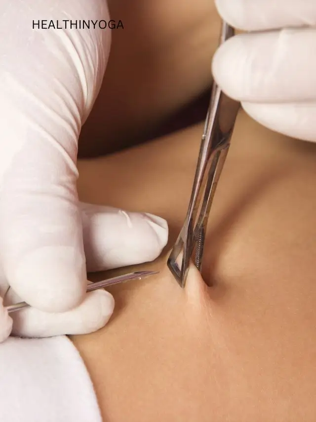 Read more about the article Nurture Your Core: Yoga Poses for Naval Realignment