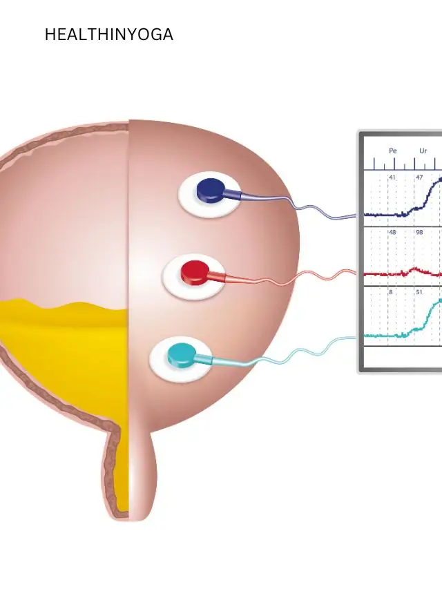 Read more about the article BEST 10 YOGA  FOR URETHRA PAIN